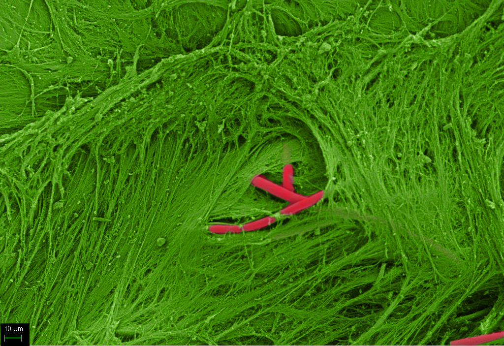 Nanofiber Technology in Biomedical Engineering and Drug Delivery